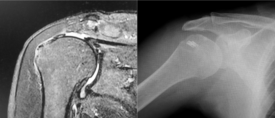 九州大学 整形外科学教室 肩関節グループ