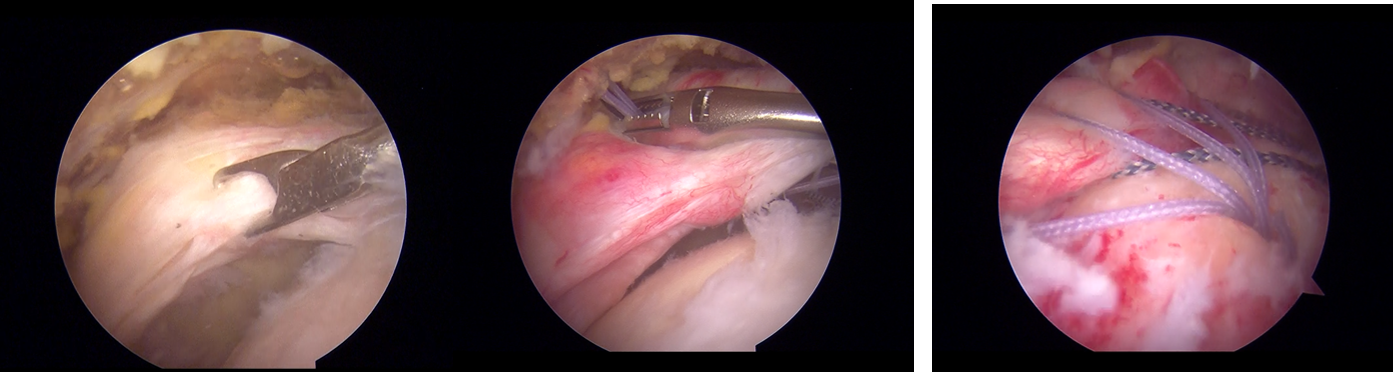 九州大学 整形外科学教室 肩関節グループ