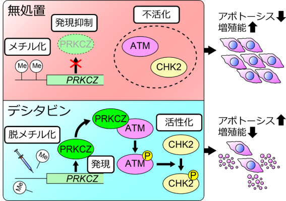 ユーイング肉腫はどのように診断されますか?